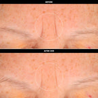 SEPHORA COLLECTION — Face Tape